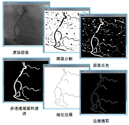 機(jī)器視覺-應(yīng)用實(shí)例